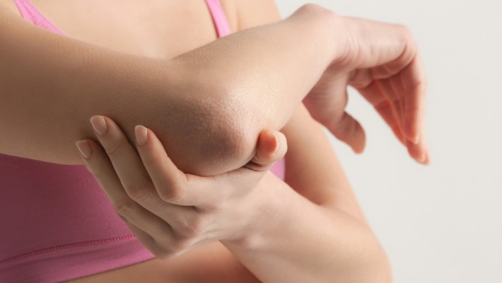 Dirsek Çürütme: Masum Alışkanlık, Kalıcı Koyulaşma!