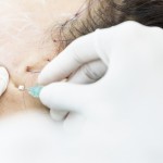 İğne ve İplikle Gelen Güzellik